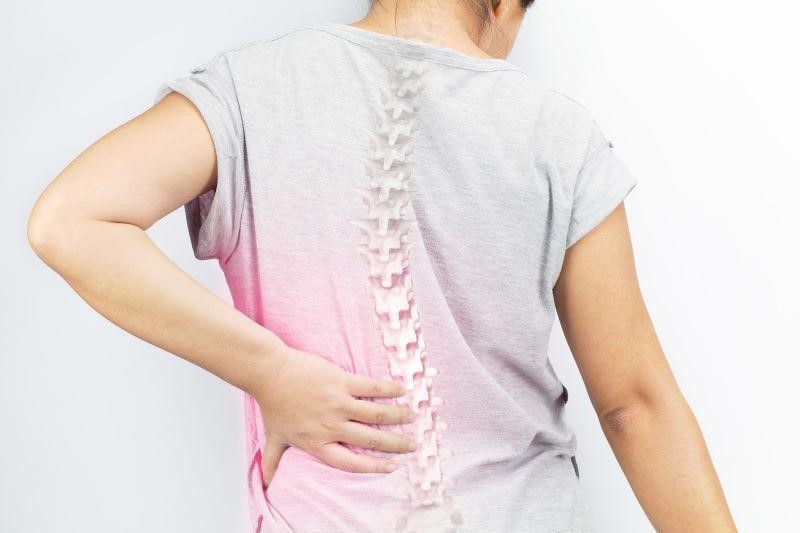 Đau hông trái có thể là triệu chứng của thoái hóa cột sống thắt lưng