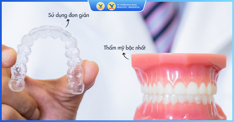 nha khoa niềng răng uy tín