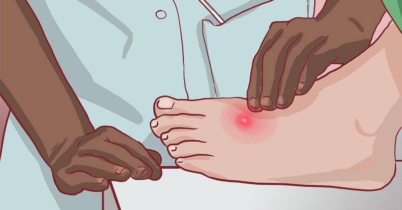 cách chữa mụn nhọt sưng to