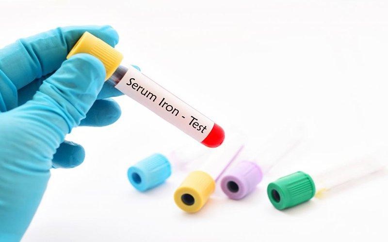 Xét nghiệm sắt huyết thanh giúp xác định chỉ số sắt trong máu