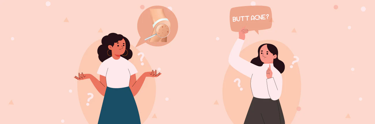 Mụn nhọt ở mông xuất hiện vì nhiều nguyên nhân khác nhau