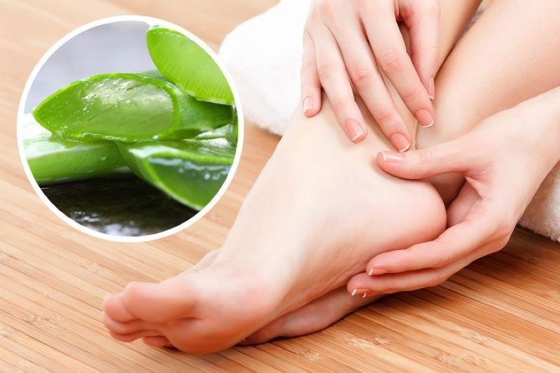 Cải thiện tình trạng da chân tróc vảy trắng với nha đam