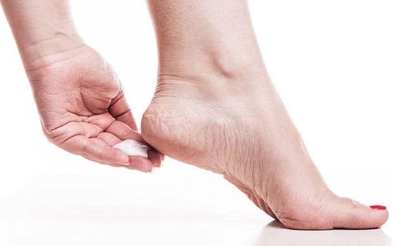 Bôi kem dưỡng da chân mỗi ngày