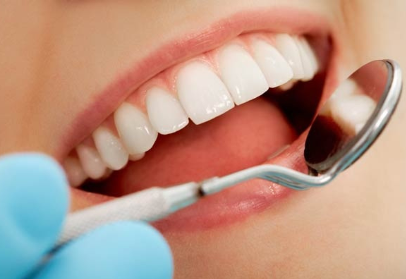 lấy tủy bọc răng sứ giá bao nhiêu