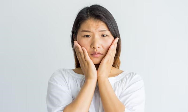 Mặt to béo, chảy xệ, phù thủng khiến nhiều người tự ti