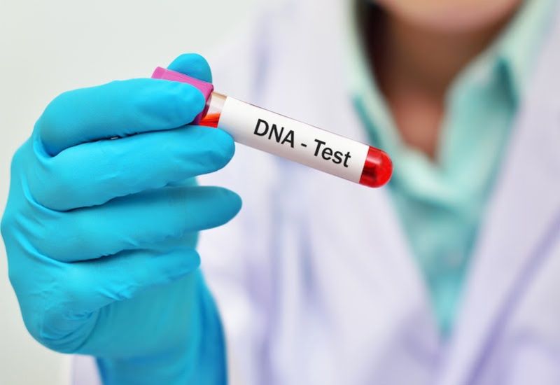Xét nghiệm DNA virus là xét nghiệm quan trọng để đánh giá mức độ hoạt động của virus 